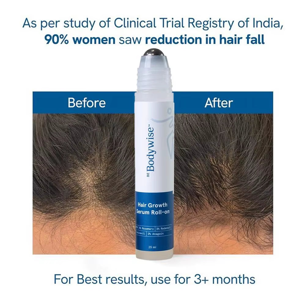 RoseGrow™ Hair Growth Serum – Deep Scalp Nourishment & Frizz Control for Stronger Hair Roots
